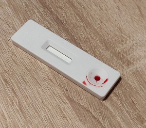 Covid-19 Antikörpertest